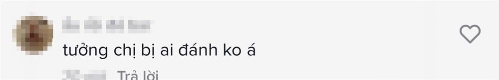 Chuyện gì đây, Thu Minh xuất hiện với cơ thể bầm dập?-8