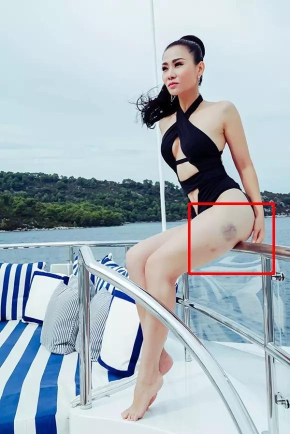 Chuyện gì đây, Thu Minh xuất hiện với cơ thể bầm dập?-11