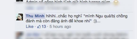 Chuyện gì đây, Thu Minh xuất hiện với cơ thể bầm dập?-15