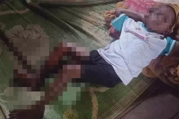 Thực hư thông tin bé trai 8 tuổi bị tẩm xăng đốt vì không chịu đi ăn trộm-2