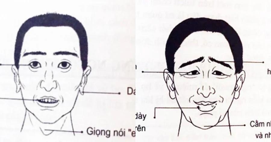 Gặp đàn ông có 6 nét tướng này, chị em chớ dại xiêu lòng-2