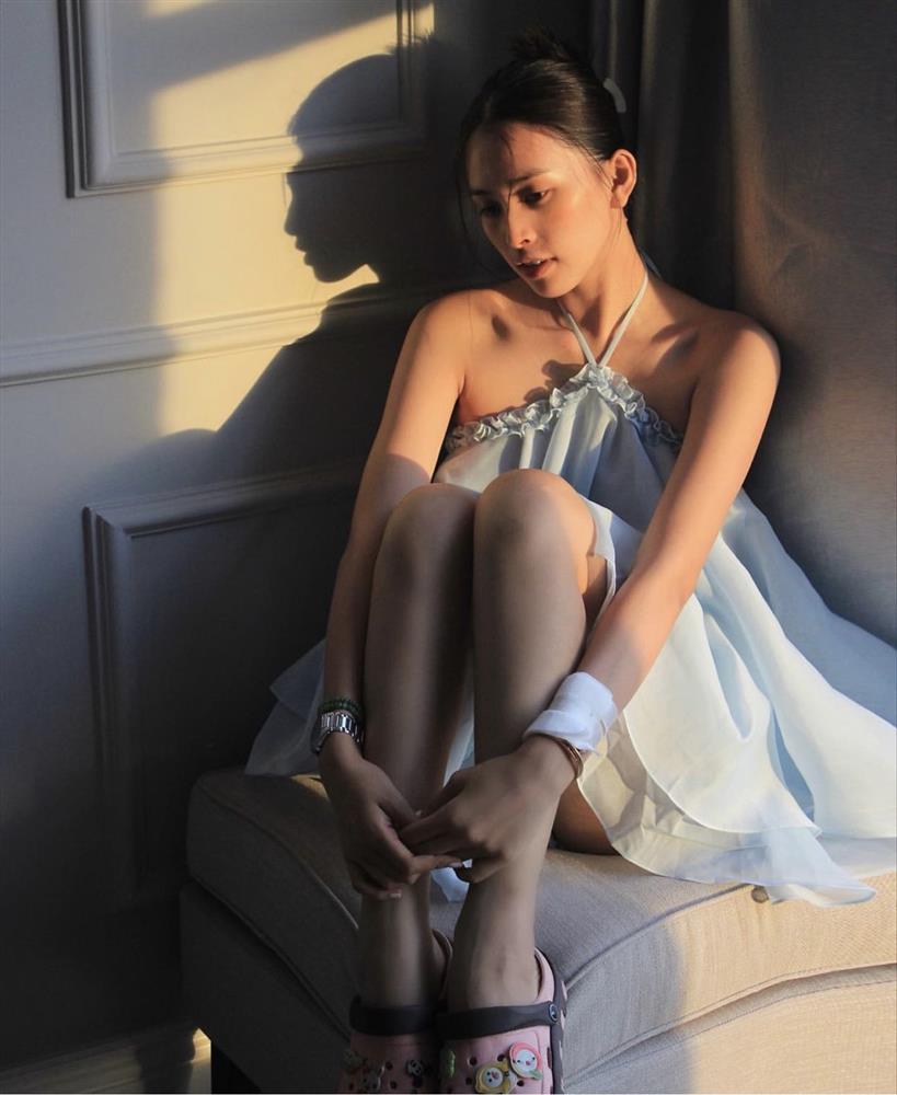 Tiểu Vy để mặt mộc, cổ tay chằng chịt bông băng gây lo lắng-3