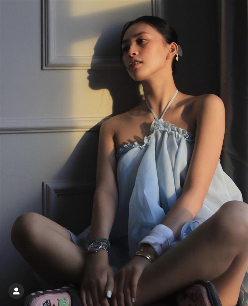 Tiểu Vy để mặt mộc, cổ tay chằng chịt bông băng gây lo lắng-1