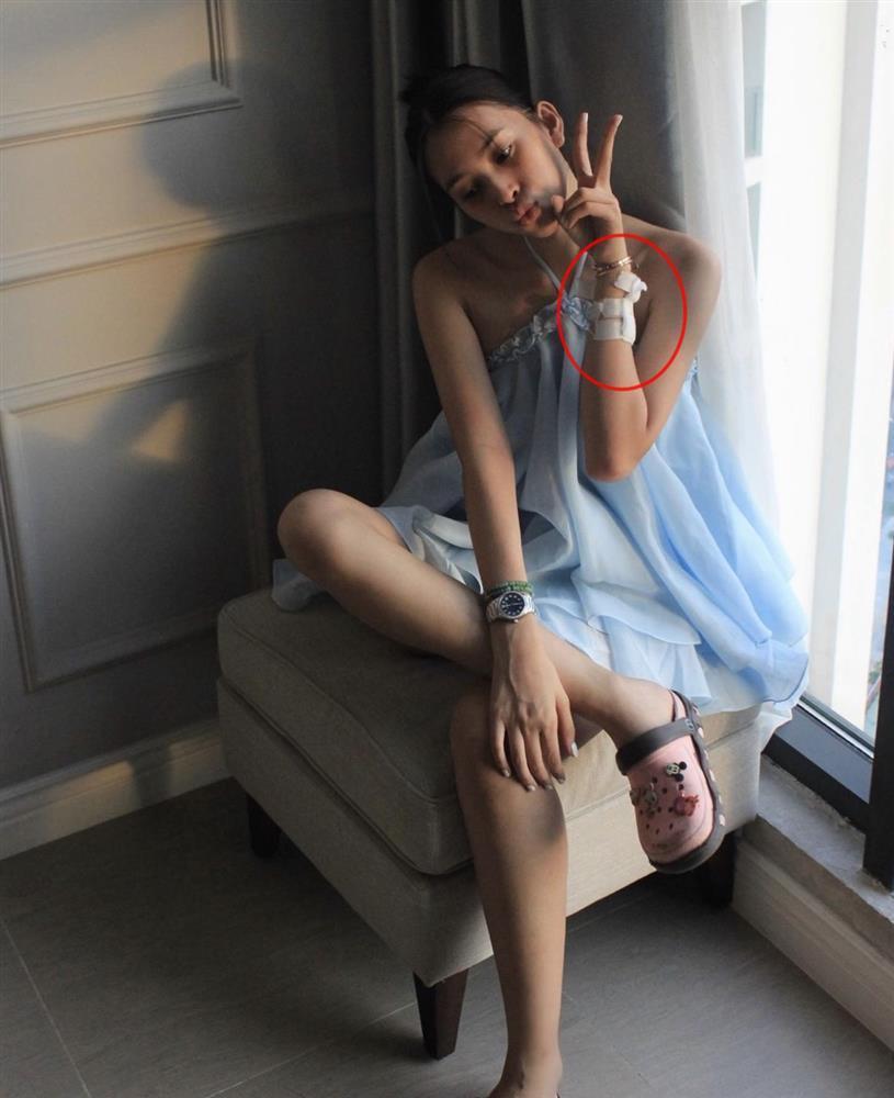 Tiểu Vy để mặt mộc, cổ tay chằng chịt bông băng gây lo lắng-4