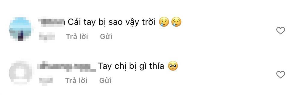 Tiểu Vy để mặt mộc, cổ tay chằng chịt bông băng gây lo lắng-6