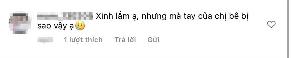 Tiểu Vy để mặt mộc, cổ tay chằng chịt bông băng gây lo lắng-7