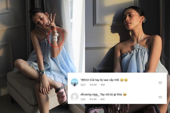 Tiểu Vy để mặt mộc, cổ tay chằng chịt bông băng gây lo lắng