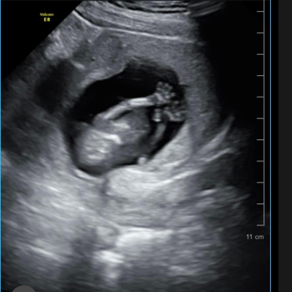 MC Thu Hoài xác nhận mang thai với chồng đại gia, sao Việt chúc mừng-3