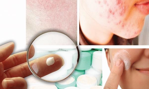 Trấn Thành gặp nạn vì bôi kem trộn-3