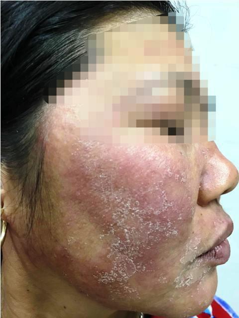 Trấn Thành gặp nạn vì bôi kem trộn-6