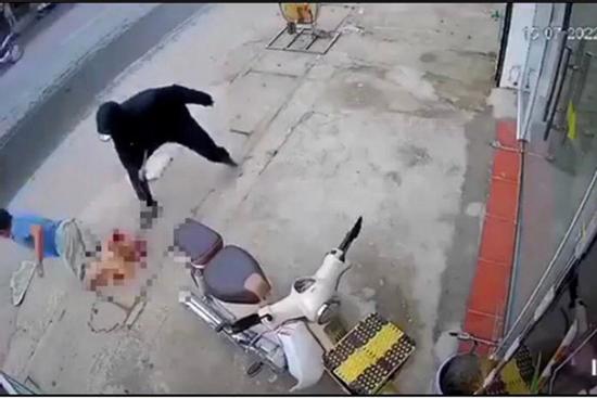 Đang đi đường, người đàn ông bị chém lìa chân ở Thường Tín