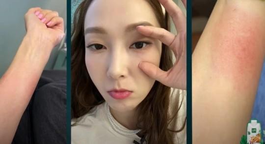 Cựu thành viên SNSD Jessica vẫn tỏa sáng bất chấp chấn thương-2