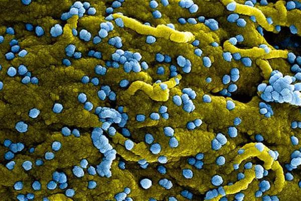 Trung Quốc phát hiện loại virus mới, chưa có thuốc chữa-2