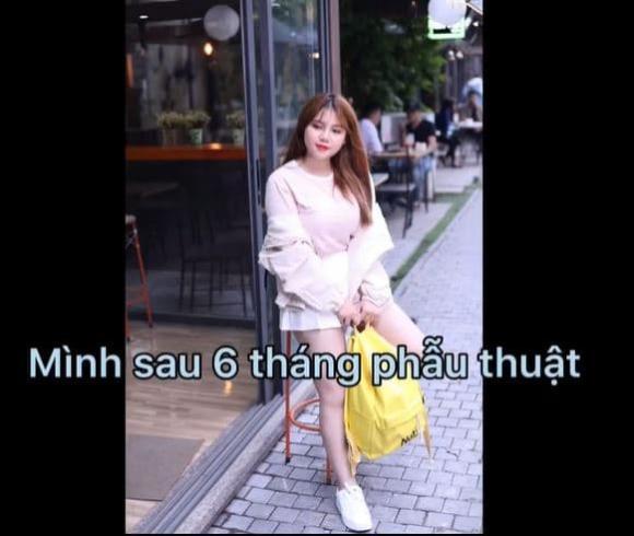 Nữ sinh Hải Dương nói lý do hút mỡ rồi ngực vẫn to như quả bóng-4