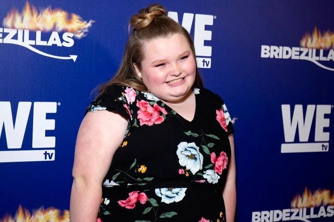 Hoa hậu nhí phẫu thuật để giảm 124 kg xuống 68 kg-1