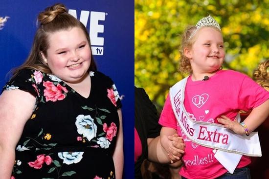 Hoa hậu nhí phẫu thuật để giảm 124 kg xuống 68 kg