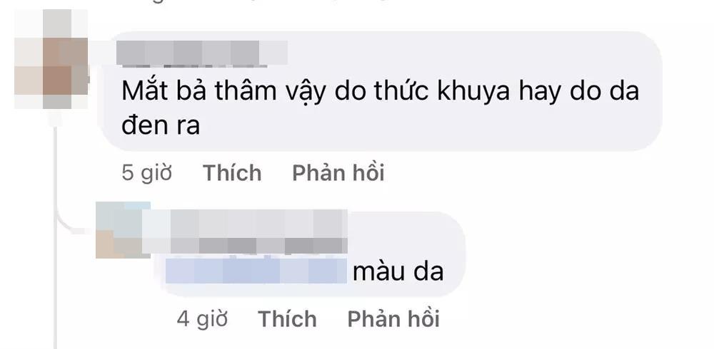 Miss Universe 2021 lộ mặt mộc quầng thâm như thiếu ngủ-7