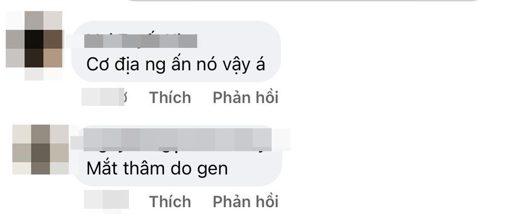 Miss Universe 2021 lộ mặt mộc quầng thâm như thiếu ngủ-8