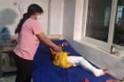 Khởi tố đối tượng tẩm xăng đốt chân bé trai 8 tuổi ở Đắk Lắk