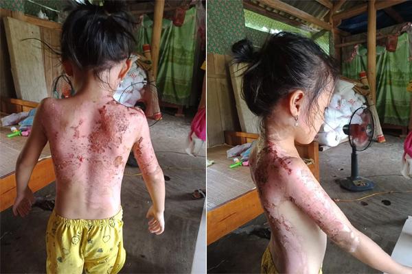 Thanh niên mất mạng vì quan hệ tình dục bạo dâm-2