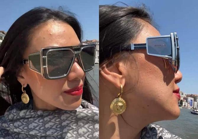 Kim Duyên lộ mặt tì vết sau thành tích Á hậu Miss Supranational-3