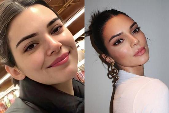 4 chiêu giúp Kendall Jenner đánh bay mụn, lấy lại da láng mịn