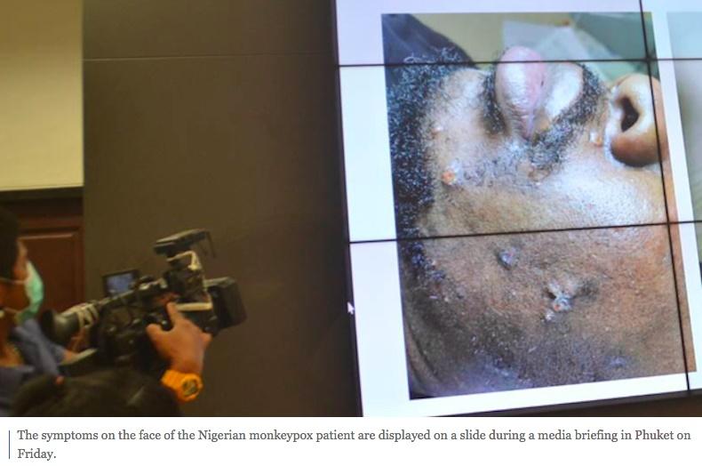 Bắt giữ người đàn ông mắc đậu mùa khỉ, gieo rắc nỗi sợ hãi ở Campuchia-2