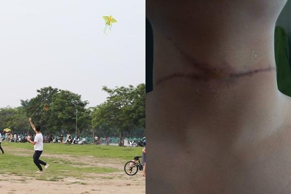 Cây cô đơn ở hồ Tây gãy đổ nhánh chính sau cơn mưa lớn-2