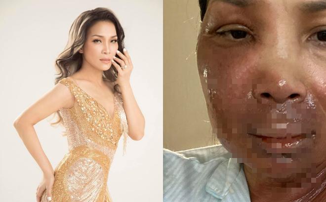 Hồng Ngọc tự tin đọ sắc Hương Giang sau 2 năm bỏng kinh hoàng-3