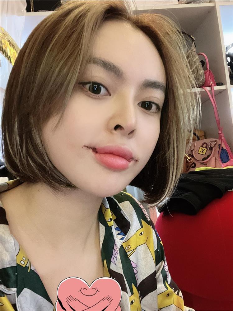 Trang Nemo tung ảnh khâu môi chằng chịt như cá chép-2