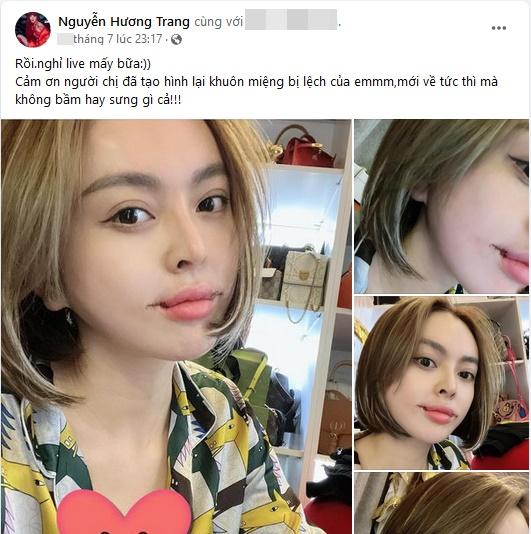 Trang Nemo tung ảnh khâu môi chằng chịt như cá chép-1