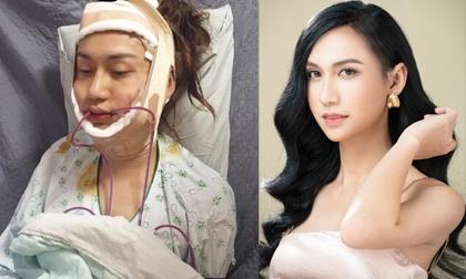 Lynk Lee hoàn tất ca phẫu thuật cuối, kết thúc hành trình chuyển giới-3