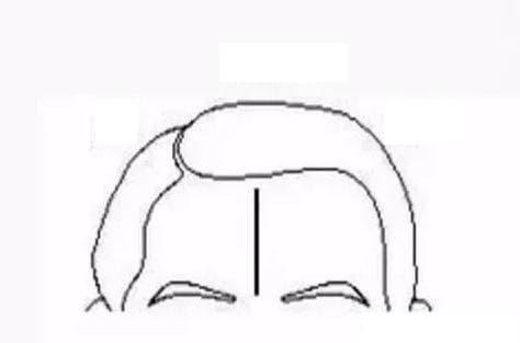 Những người có đường vân thiên trên trán thường đạt sự nghiệp lớn-4