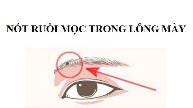 Trẻ có 4 nốt ruồi tượng trưng Tài - Lộc - Phúc, trọn đời gặp điều may-2