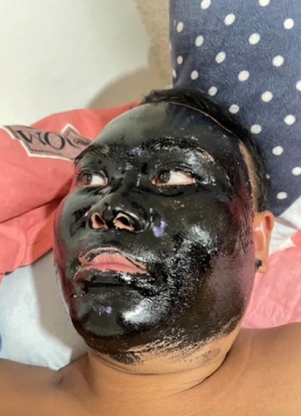 Tự làm đẹp bằng mặt nạ của vợ, chồng thốn tận rốn, tởn đến già-2