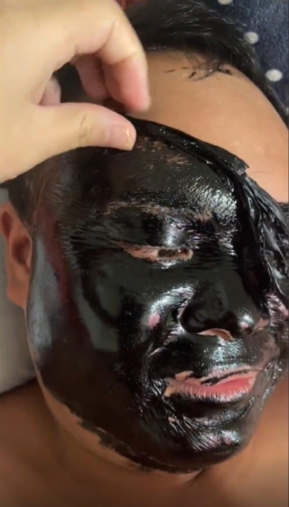 Tự làm đẹp bằng mặt nạ của vợ, chồng thốn tận rốn, tởn đến già-4