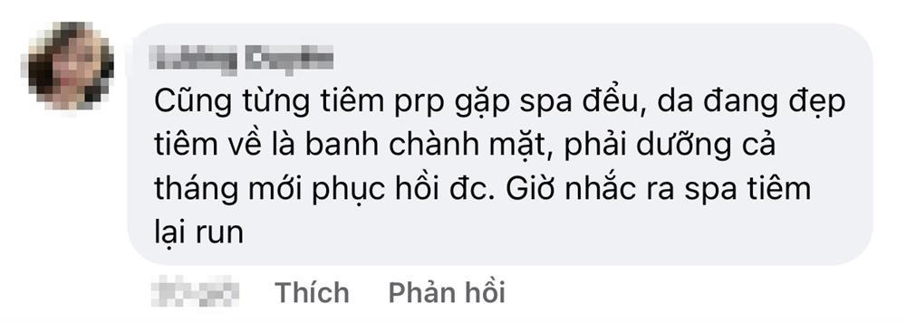 Phát hoảng với gương mặt tổ ong nghìn lỗ vì tiêm da meso-5