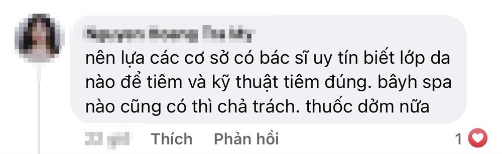 Phát hoảng với gương mặt tổ ong nghìn lỗ vì tiêm da meso-7
