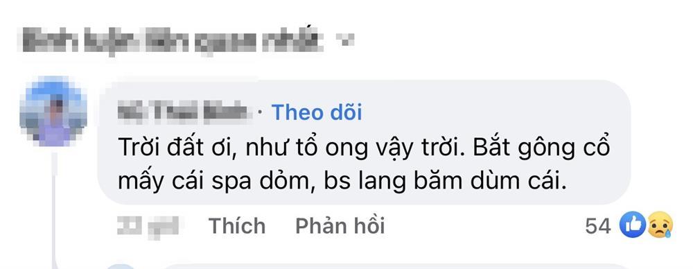 Phát hoảng với gương mặt tổ ong nghìn lỗ vì tiêm da meso-9