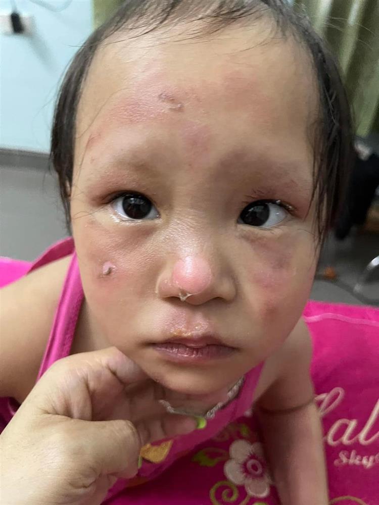 Để bóng bay gần nến, lung linh chưa thấy đã nổ mặt em bé đen sì-3