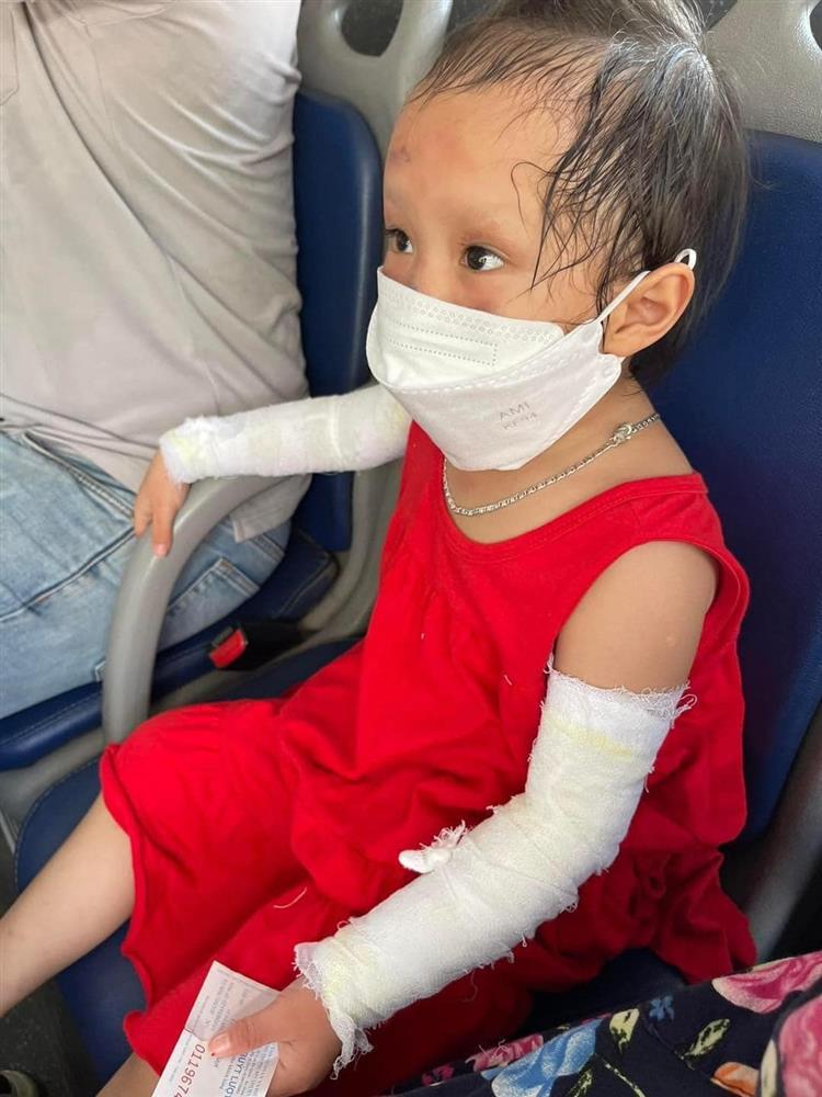 Để bóng bay gần nến, lung linh chưa thấy đã nổ mặt em bé đen sì-4