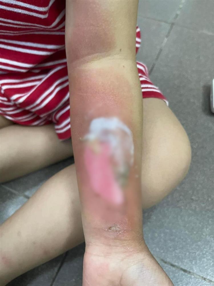 Để bóng bay gần nến, lung linh chưa thấy đã nổ mặt em bé đen sì-5