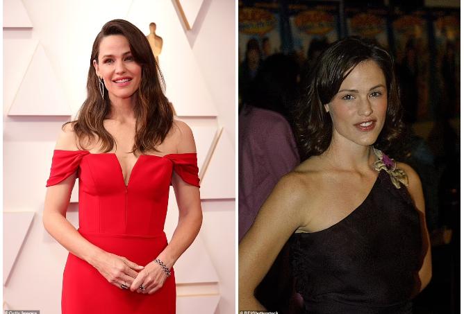 Nữ diễn viên cảnh báo tiêm botox-1