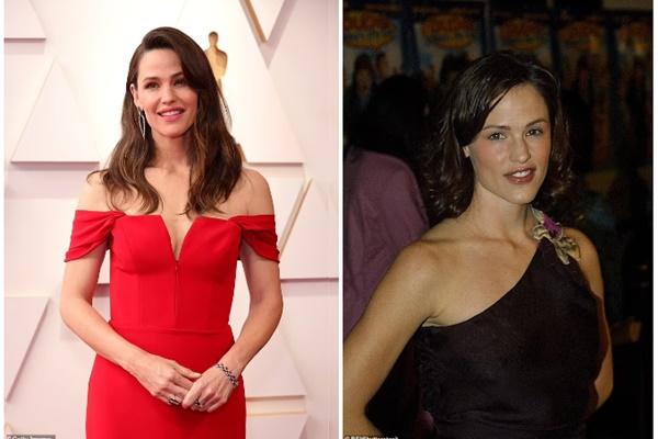 Tác hại tiềm ẩn khi 20 tuổi đã tiêm botox-3