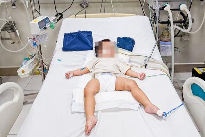 Bé gái 1 tuổi bị bạo hành ở Hà Nội có dấu hiệu di chứng thần kinh-1
