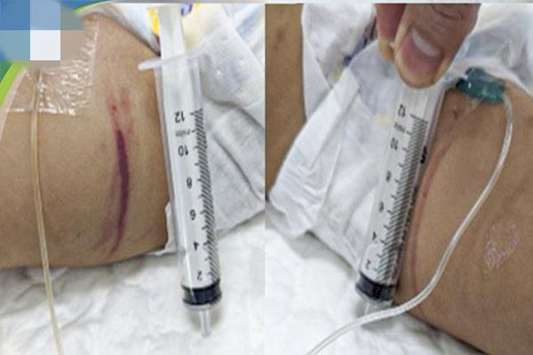 Vụ bé 1 tuổi bị bạo hành: Hàng xóm thường nghe tiếng trẻ con khóc-5