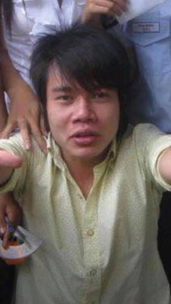 Lê Dương Bảo Lâm rụng răng sứ vì chơi gameshow quá máu-3