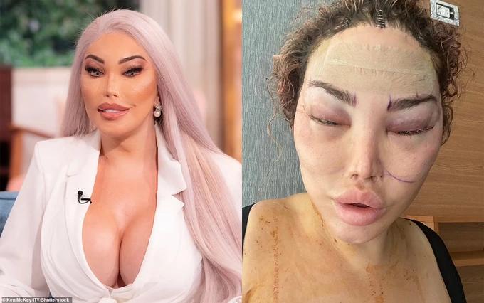 Sao chuyển giới Jessica Alves lộ diện sau ca thẩm mỹ lần thứ 90-1