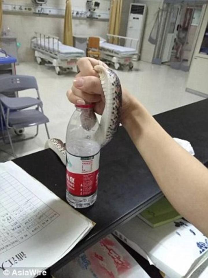 Xanh mặt cô gái điềm tĩnh cầm rắn sống bước vào phòng cấp cứu-3