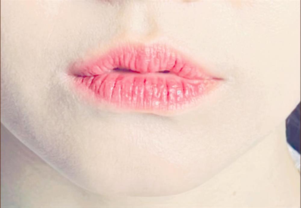 Hari Won tiết lộ bệnh tình giữa thời điểm hôn nhân phủ sóng-4